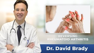 Osteoarthritis vs Rheumatoid Arthritis Nursing  Symptoms Pathophysiology Treatment Mnemonic NCLEX [upl. by Decamp]