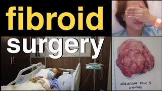 FIBROID SURGERY  ABDOMINAL MYOMECTOMY  PRE  POST OP amp RECOVERY  BEHIND THE SCENES VLOG  Part 1 [upl. by Aicilev493]