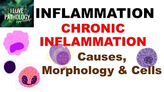 INFLAMMATION 8 CHRONIC INFLAMMATION Causes Morphology amp Cells [upl. by Assadah]