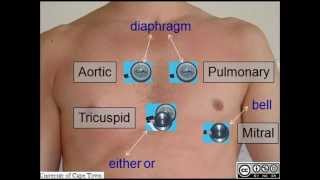 AUSCULTATION OF HEART SOUNDS [upl. by Eusebio146]