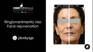 RINGIOVANIMENTO VISO CON PLENHYAGE  BIOFORMULA [upl. by Lipkin]