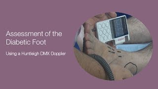 Assessment of the Diabetic Foot using a DMX Doppler [upl. by Narba]