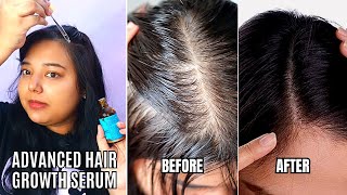 How To Apply Pilgrim Hair Growth Serum For Hair Regrowth Pilgrim Redensyl Anagain Hair Growth Serum [upl. by Silevi]