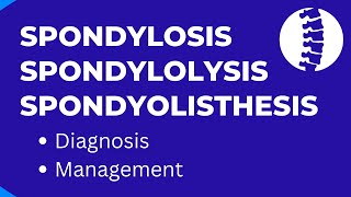 Spondylosis Spondylolysis Spondyolisthesis Difference Diagnosis amp Management [upl. by Vidda]