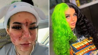 TikTok star BeastEater confirms infection ‘almost killed me’ [upl. by Thar]