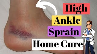 High Ankle Sprain Treatment Causes amp Best Recovery Time [upl. by Carolee]