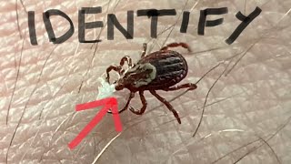 TRICKS for TICKS Photo Identification  PICTURES [upl. by Janaya]