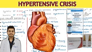 Hypertensive crisis hypertensive urgency and hypertensive emergency treatment in hindi [upl. by Kallick]