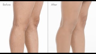 How to Cover Spider Veins on Legs with Makeup  jane iredale [upl. by Nwahsor]