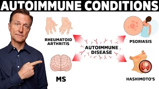 7 Surprising Causes of Autoimmune Diseases They Never Told You About [upl. by Fiorenze]