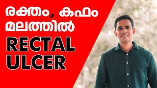 രക്തം കഫം മലത്തിൽ  RECTAL ULCER [upl. by Aya933]