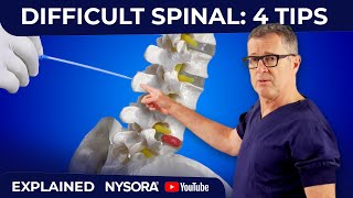 What to do when the needle encounters the bone during spinal or lumbar puncture [upl. by Catarina]