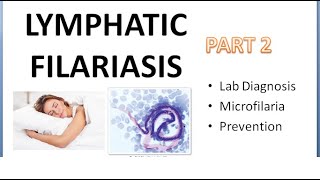 PSM 290 Lymphatic Filariasis Part 2 Lab Diagnosis Microfilaria Prevention DEC Provocation Test [upl. by Ynaittirb588]