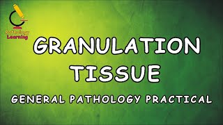 Granulation Tissue  General Pathology Practical   Learning Pathology [upl. by Dun]