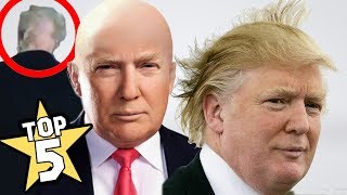 TOP 5  DONALD TRUMPS BALD SPOT SHOCKING FACTS [upl. by Anidal]