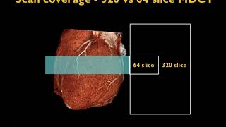 Cardiac CT Physics [upl. by Enorel464]