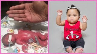 Diors Journey  Preemie Born at 23 Weeks [upl. by Yna321]