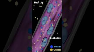 Selfcontrolling insulin in diabetes science medicine diabetes blender biology [upl. by Alage]