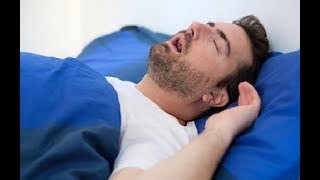 Hypersomnia the causes and treatment of sleep disorders [upl. by Nerok]