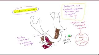 Mandibular fracture PART 1 [upl. by Odlawso499]