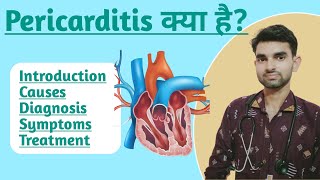 Pericarditis in Hindi  Causes Symptoms Diagnosis and Treatment of Pericarditis in Hindi [upl. by Airat]