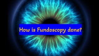 How to do Fundoscopy How to examine the retina [upl. by Linnie]