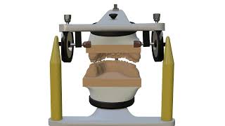 Occlusion Articulator parameters [upl. by Furgeson285]