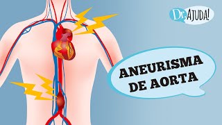 ANEURISMA DE AORTA O QUE É SINTOMAS E TRATAMENTO [upl. by Adnwahsar]