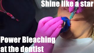 Power bleaching Tooth whitening at the dentist Inoffice  shine like a star [upl. by Nanerb]