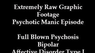 Extreme Graphic Psychosis Mania Bipolar Disorder Full Blown Manic Episode Raw Footage [upl. by Ahsyek465]