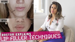 Which Lip Filler Technique 5 Case Studies for BEST RESULTS  Doctor Explains 💋💉 [upl. by Hilliary]