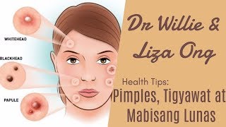 Pimples Tigyawat at Mabisang Lunas – by Doc Katty Go Dermatologist 33 [upl. by Berfield161]