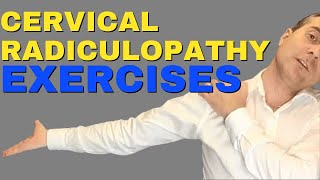 Best Cervical Radiculopathy Exercises  Exercises For Cervical Radiculopathy Dr Walter Salubro [upl. by Zubkoff]