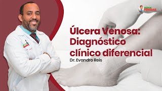 Úlceras Venosas Diagnóstico diferencial [upl. by Calendre]