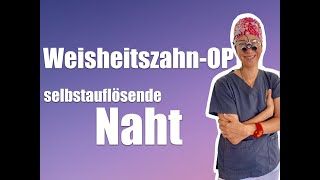 WANN lösen sich die FÄDEN nach der WEISHEITSZAHNOP auf EXPERTENTIPP [upl. by Annasoh873]