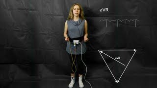 ECG The augmented limb leads aVF aVR and aVL [upl. by Ellirpa606]