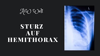 Sturz auf den Hemithorax was zu tun [upl. by Giraud15]