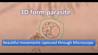 Motile trophozoite of Trichomonas under the Microscope [upl. by Ilek506]