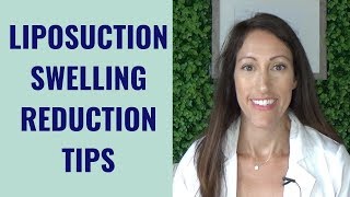 Liposuction Healing amp Recovery Tips  How to REDUCE Lipo Swelling  Post Liposuction Care Guide [upl. by Sandor93]