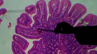 Histologia do Intestino Delgado [upl. by Ycnan]