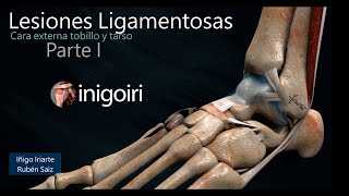 US EN LESIONES LIGAMENTOS EXTERNOS DEL TOBILLO PARTE I [upl. by Isdnyl]