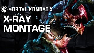 Bone Crunching XRays  Mortal Kombat X [upl. by Skardol]