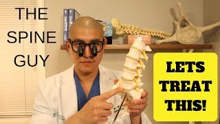 Lumbar Disc Herniation Part 3 Treatment options [upl. by Emile]