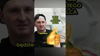 😱TNIEMY KCIUKA Implant Zęba Czy Leczenie Kanałowe 🤔 [upl. by Cathe]