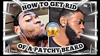 HOW TO FIX A PATCHY BEARD  PATCHY BEARD SOLUTION [upl. by Ultima738]