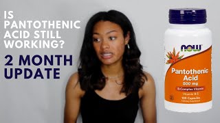 Pantothenic Acid for Acne Update  2 Months on Pantothenic Acid [upl. by Nelad]