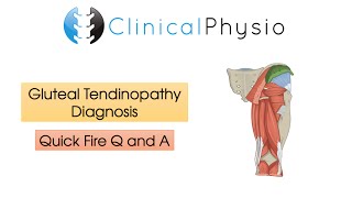 Classic Gluteal Tendinopathy Diagnosis  Clinical Physio [upl. by Ramsden]