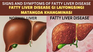 Fatty Liver Disease gi Laiyongsingi Matangda Khangminasi Manipuri [upl. by Pardew150]