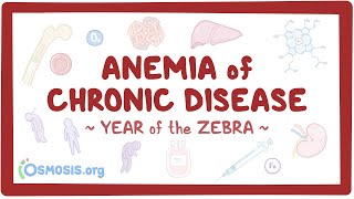 Anemia of chronic disease Year of the Zebra [upl. by Airtemak]