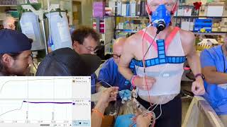 Cardiac Output measurement using thermodilution [upl. by Sawyere36]